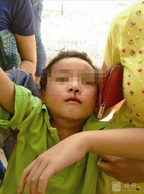 陕西延安市延长县一家幼儿园发生中毒事件(图2) 陕西延安市延长县一家幼儿园发生中毒事件(图2)